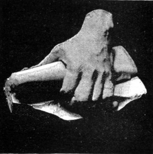 LORD NAPIER OF MAGDALA'S HAND.