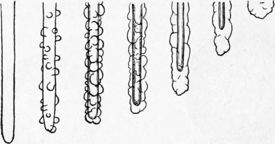 Zusammenziehen der Pseudopodien   von Difflugia