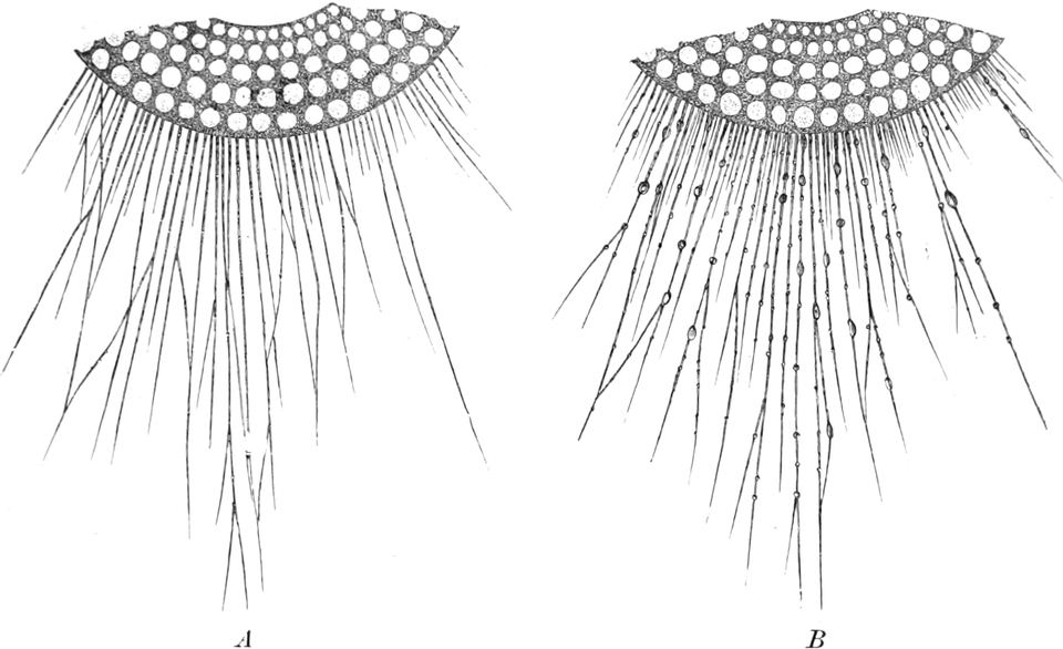 Pseudopodien eines Sonnentierchens   nach Reizung