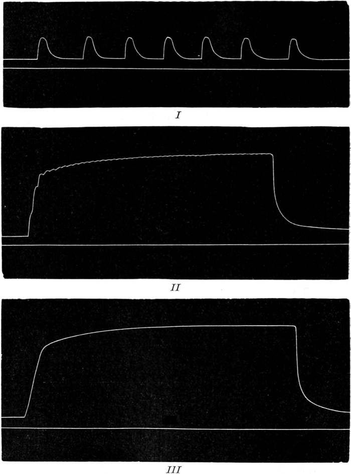 Myographische Kurven vom   Wadenmuskel eines Frosches