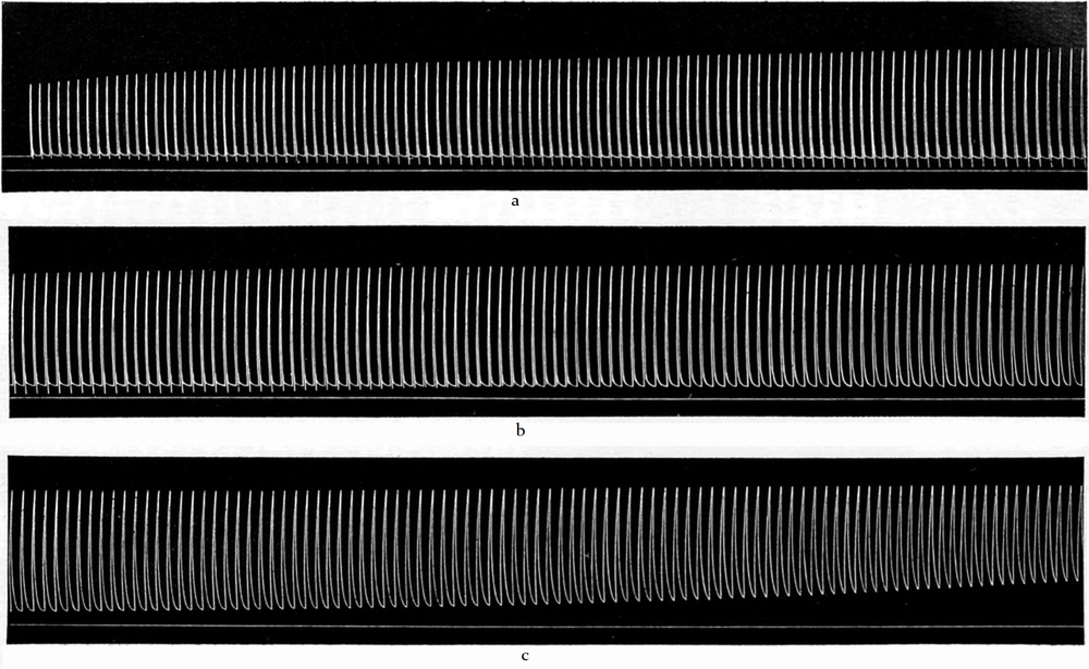 Arbeitslähmung eines   Froschmuskels, a-c