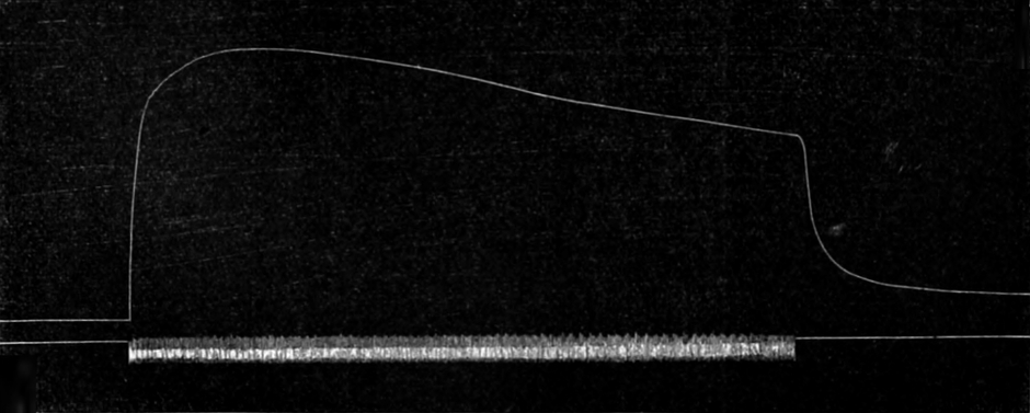 Krampf eines Froschmuskels