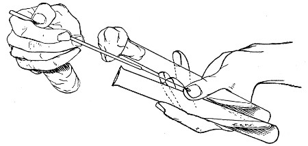 Fig. 117.&mdash;Inoculating tubes, seen from the front.