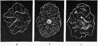 Fig. 146.&mdash;Types of colonies: a, Reticulate; b,
gyrose; c, marmorated.