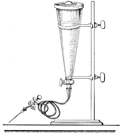 Fig. 173.&mdash;Conical separatory funnel, fitted for
injection of fluid cultivations.