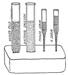 Fig. 194.&mdash;Plasticine block with materials arranged for
opsonin estimations.