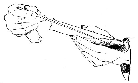 Fig. 68.&mdash;Holding tubes for removing bacterial growth, as
seen from the front.