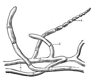 Fig. 80.&mdash;O&iuml;dium.