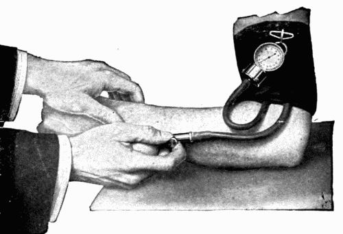 Fig. 18.&mdash;Rogers' "Tycos" dial sphygmomanometer.