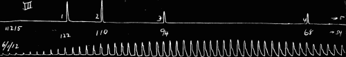 Fig. 31.&mdash;Fast drum. Sudden decrease in size of pulse wave at 4, marking the change
from clear sharp tone to dull tone.