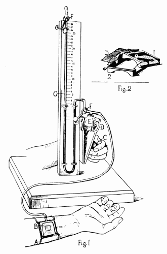 Fig. 33.&mdash;Apparatus for estimating the venous blood pressure in man, devised by
Drs. Hooker and Eyster. The small figure is the detail of the box B. See explanation
in text.