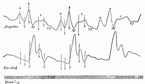 Fig. 36.&mdash;Simultaneous tracings of the jugular and carotid pulses showing normal waves
in the venous pulse and relation to carotid pulse. (After Bachmann.)