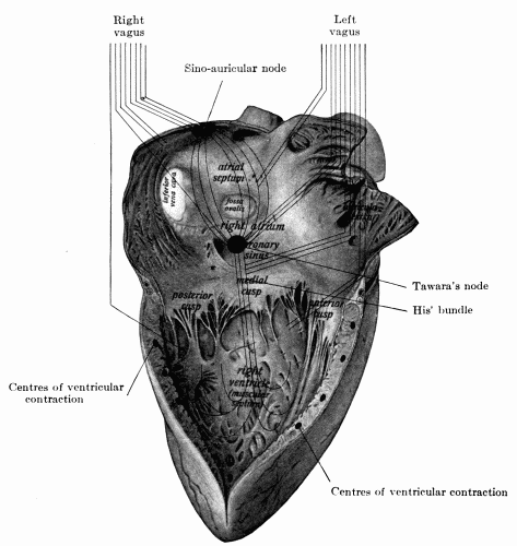 Fig. 38.&mdash;Right side of the heart showing diagrammatically the distribution of the
two vagus nerves to different parts of the viscus....(Hare's Practice of Medicine.)