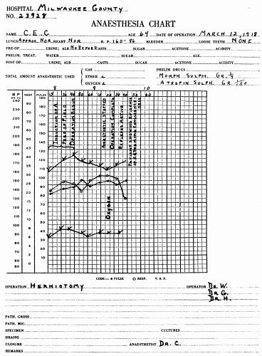 Fig. 54.&mdash;Blood pressure record from a normal reaction to ether. Note that the
systolic and diastolic rise and fall together. At the end of the anesthetization the pulse
pressure is practically the same as at the beginning. Compare this with the record in
Fig. 55, where the operation had to be discontinued on account of the onset of shock.
